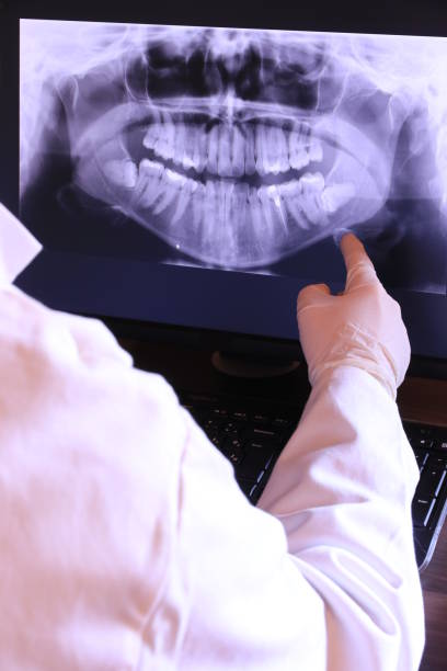 Best Broken or Chipped Tooth Repair in Chalmette, LA